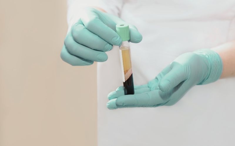 PRP skin therapy at Hermanos Aesthetics Cape Town for collagen stimulation, anti-aging and skin rejuvenation.